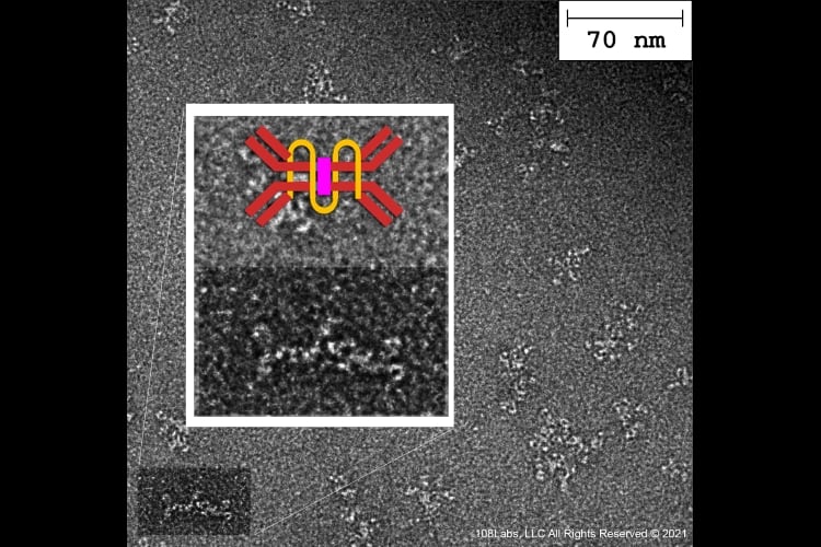 First-electron-micrograph-of-108Labs-secretory-antibodies.jpg