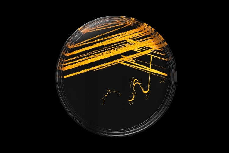 Novozymes acquires PrecisionBiotics