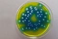 Get Bacillus cereus testing results according to ISO 21871 24 hours faster 