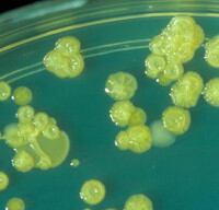cronobacter_b200px_medium.jpg