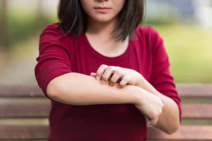 eczema-skin-rash-children-iStock-champja.jpg