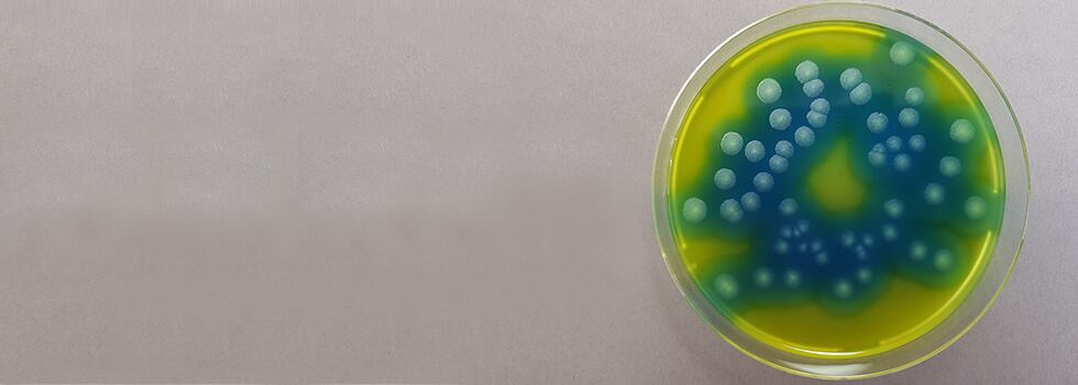 Get-Bacillus-cereus-testing-results-according-to-ISO-21871-24-hours-faster.jpg