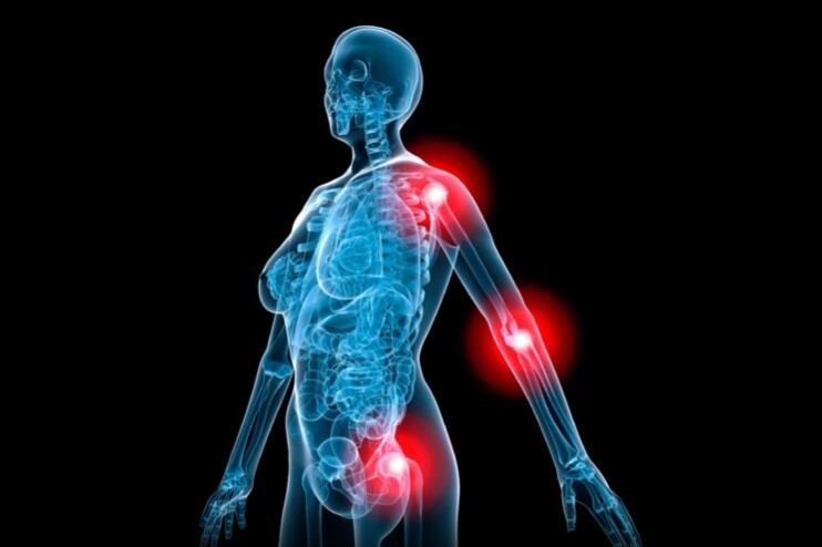 Bone supporting effect of vitamin K2-rich cheese ‘stretches credulity,’ expert says  