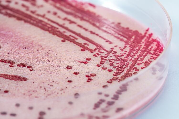 New Zealand dairy company fined $483,000 for falsifying Listeria results