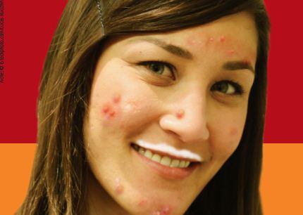 zit-face.jpg