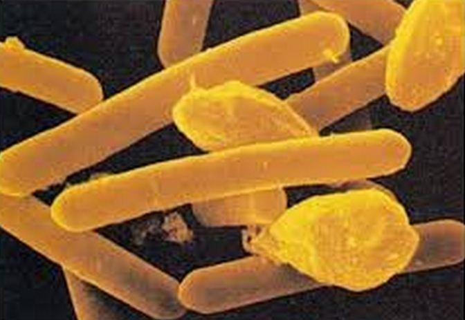 NZ launches probe into Fonterra WPC Clostridium botulinum crisis
