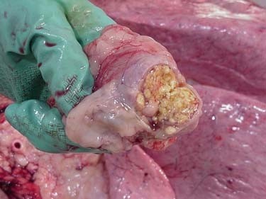 A gross lesion in a cow with TB